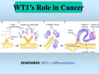 REMEMBER: WT1 = differentiation
 