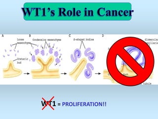 WT1 = PROLIFERATION!!
 