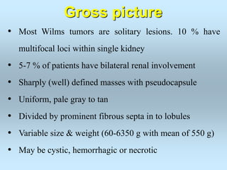 • Most Wilms tumors are solitary lesions. 10 % have
multifocal loci within single kidney
• 5-7 % of patients have bilateral renal involvement
• Sharply (well) defined masses with pseudocapsule
• Uniform, pale gray to tan
• Divided by prominent fibrous septa in to lobules
• Variable size & weight (60-6350 g with mean of 550 g)
• May be cystic, hemorrhagic or necrotic
Gross picture
 