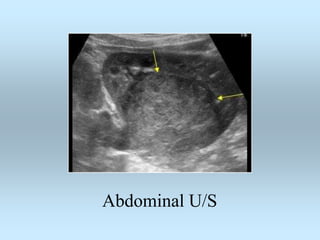 Abdominal U/S
 