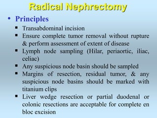 • Principles
 Transabdominal incision
 Ensure complete tumor removal without rupture
& perform assessment of extent of disease
 Lymph node sampling (Hilar, periaortic, iliac,
celiac)
 Any suspicious node basin should be sampled
 Margins of resection, residual tumor, & any
suspicious node basins should be marked with
titanium clips
 Liver wedge resection or partial duodenal or
colonic resections are acceptable for complete en
bloc excision
Radical Nephrectomy
 