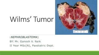Wilms’ Tumor
(NEPHROBLASTOMA)
BY: Mr. Ganesh V. Naik
II Year MSc(N), Paediatric Dept.
 