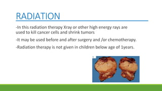 RADIATION
-In this radiation therapy Xray or other high energy rays are
used to kill cancer cells and shrink tumors
-It may be used before and after surgery and /or chemotherapy.
-Radiation therapy is not given in children below age of 1years.
 