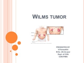 WILMS TUMOR
PRESENTED BY
V.Parasakthi
M.Sc. (N) Ist year
Dept. of CHN
CON-PIMS
 
