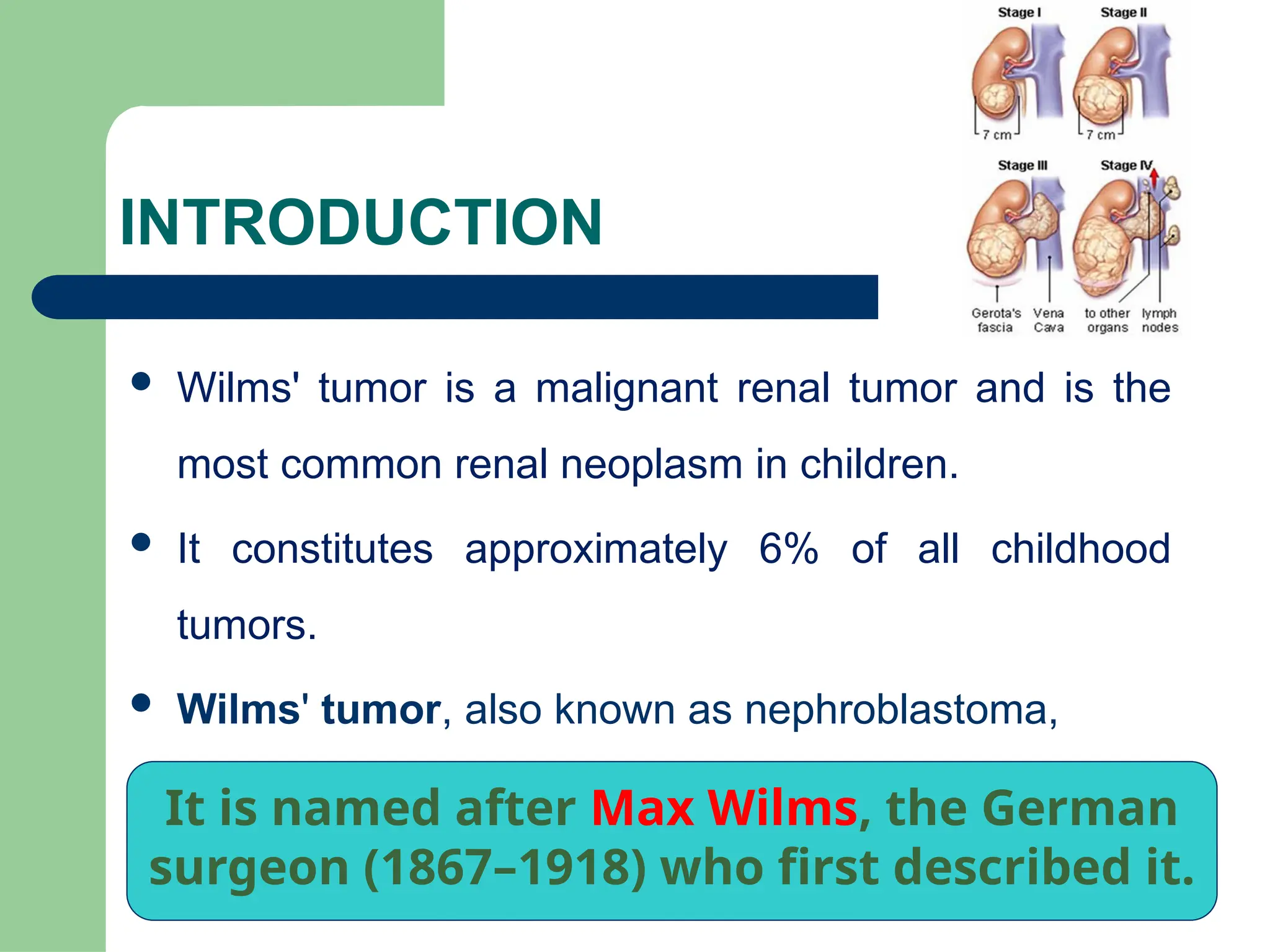 wilms tumor is malignant renal tumors and most common | PPTX