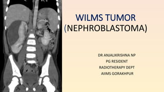 WILMS TUMOR (3).pptx radiation loncology | PPTX