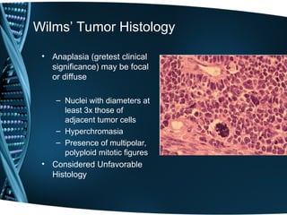 WILM'S TUMOR BY Dr.POONAM GUPTA , CHIEF CONSULTANT | PPT