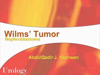 Wilms’ Tumor Nephroblastoma AbdulQadir J. Nashwan 
