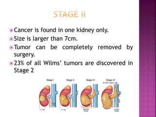 wilms tumor ppt.pptx ppt tumor wilms tumor | PPTX