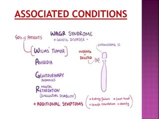 wilms tumor ppt.pptx ppt tumor wilms tumor | PPTX