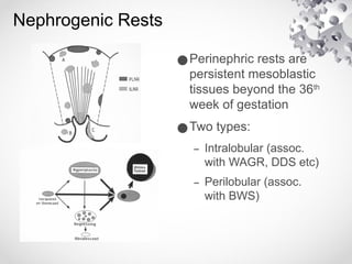 wilms tumour renal tumours in children pptx | PPTX