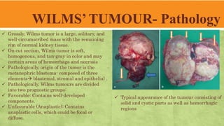WILMS’ TUMOUR- Pathology
 Grossly, Wilms tumor is a large, solitary, and
well-circumscribed mass with the remaining
rim of normal kidney tissue.
 On cut section, Wilms tumor is soft,
homogenous, and tan-gray in color and may
contain areas of hemorrhage and necrosis
 Pathologically, origin of the tumor is the
metanephric blastema- composed of three
elements blastemal, stromal and epithelial .
 Pathologically, Wilms tumours are divided
into two prognostic groups:
 Favorable: Contains well-developed
components.
 Unfavorable (Anaplastic): Contains
anaplastic cells, which could be focal or
diffuse.
 Typical appearance of the tumour consisting of
solid and cystic parts as well as hemorrhagic
regions
 