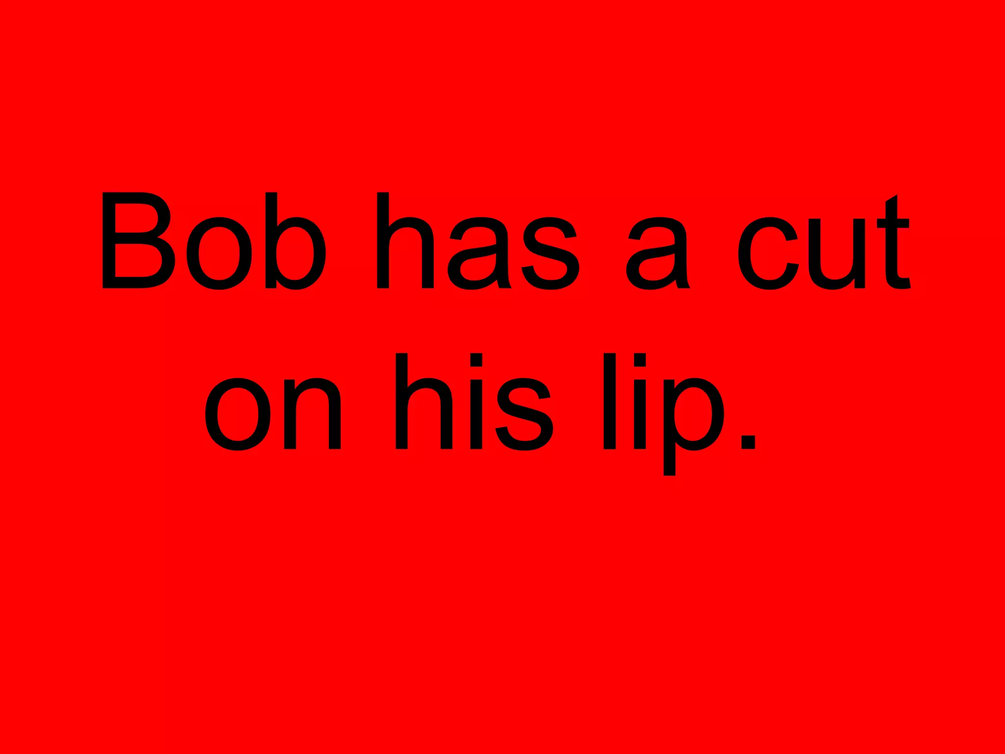 Bob has a cut
 on his lip.
 