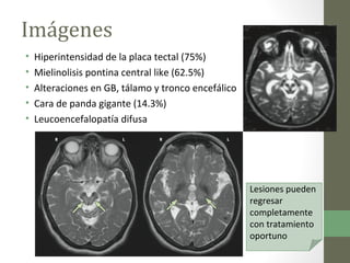 Imágenes
• Hiperintensidad de la placa tectal (75%)
• Mielinolisis pontina central like (62.5%)
• Alteraciones en GB, tála...