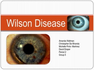 Wilson Disease
            Amanda Waltman
            Christopher De Miranda
            Michelle Pinto- Martinez
            David Draper
            Period 2
            Group 5
 