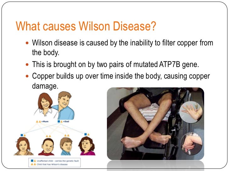 Wilson disease