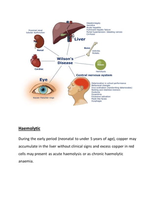Haemolytic
During the early period (neonatal to under 5 years of age), copper may
accumulate in the liver without clinical signs and excess copper in red
cells may present as acute haemolysis or as chronic haemolytic
anaemia.
 