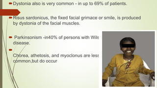 Dystonia also is very common - in up to 69% of patients.
Risus sardonicus, the fixed facial grimace or smile, is produced
by dystonia of the facial muscles.
 Parkinsonism -in40% of persons with Wilson
disease.

Chorea, athetosis, and myoclonus are less
common,but do occur
 