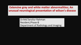 Dr.Md.Tanzilur Rahman
Resident,Phase-B
Department of Radiology and Imaging
Extensive gray and white matter abnormalities; An
unusual neurological presentation of wilson's disease
 