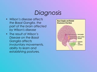 Diagnosis
• Wilson’s disease affects
the Basal Ganglia, the
part of the brain affected
by Wilson's disease
• The result of Wilson’s
Disease on the Basal
Ganglia affects
involuntary movements,
ability to learn and
establishing postures.
 