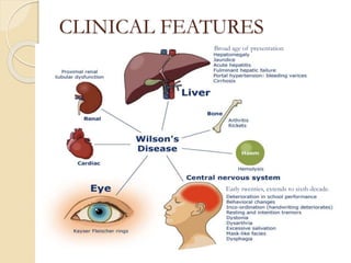 CLINICAL FEATURES
Broad age of presentation
Early twenties, extends to sixth decade.
 