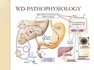 WD-PATHOPHYSIOLOGY
 