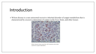 Introduction
• Wilson disease is a rare autosomal recessive inherited disorder of copper metabolism that is
characterized by excessive deposition of copper in the liver, brain, and other tissues
 