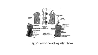 fig : Ormerod detaching safety hook
 