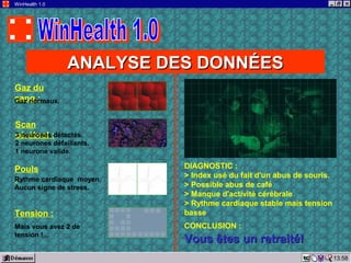 13:58
WinHealth 1.0
ANALYSE DES DONNÉESANALYSE DES DONNÉES
Gaz du
sang :Gaz normaux.
Scan
cérébral :3 neurones détectés.
2 neurones défaillants.
1 neurone valide.
Pouls
:Rythme cardiaque moyen.
Aucun signe de stress.
Tension :
Mais vous avez 2 de
tension !…
DIAGNOSTIC :
> Index usé du fait d'un abus de souris.
> Possible abus de café
> Manque d'activité cérébrale
> Rythme cardiaque stable mais tension
basse
CONCLUSION :
Vous êtes un retraité!Vous êtes un retraité!
 