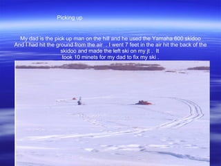 My dad is the pick up man on the hill and he used the Yamaha 600 skidoo And I had hit the ground from the air  . I went 7 feet in the air hit the back of the skidoo and made the left ski on my jt .  It  took 10 minets for my dad to fix my ski . Picking up 