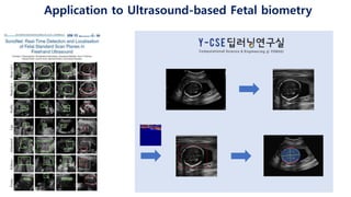 Application to Ultrasound-based Fetal biometry
 