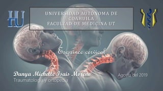 Agosto del 2019Danya Michelle Isais Moreno
Traumatología y ortopedia
Esguince cervical
UNIVERSIDAD AUTÓNOMA DE
COAHUILA
FACULTAD DE MEDICINA UT
 