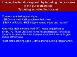 cellobiose (0.05%), Rumen fluid (30%), Butyrivibrio fibrisolvens (ATCC 19171)Conclusion:B. fibrisolvens  was detectable in rural children 