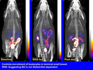 Suggesting that a Commensal bacterium found in the environment can colonize human intestine.R. Balamurugan et al, Micro Ecol Heal & Dis. 2009; 21: 3843