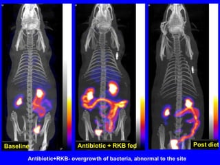 Detection of Clostridium difficile in feces of patients with UC. Expt n°4resultsR. Balamurugan et al, 2008IJMR. 