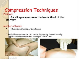 Sternal Compression Unit_II_Respiratory_Emergency.pptxetfffggf | PPTX