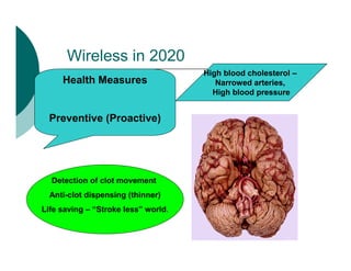 Wireless in 2020
Health Measures
Preventive (Proactive)
Detection of clot movement
Anti-clot dispensing (thinner)
Life saving – “Stroke less” world.
High blood cholesterol –
Narrowed arteries,
High blood pressure
 