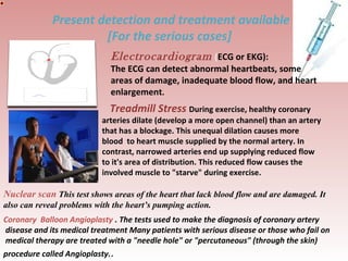 Present detection and treatment available
[For the normal cases]
Heart Basics 101 provides the
viewer with fundamental
inf...
