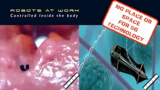 R o b ot s At w o r k


C o n t r o l l e d I n s i d e t h e b o d y
No
Place or
space

 for 5G
technology

 