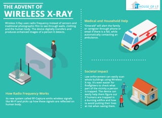The Advent of Wireless X-Ray