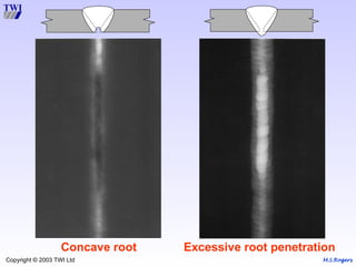 M.S.Rogers
Copyright © 2003 TWI Ltd
Concave root Excessive root penetration
 