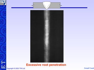 Faisal Yusof
TE
Copyright © 2003 TWI Ltd
Excessive root penetration
 