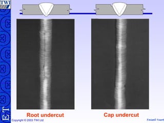 Faisal Yusof
TE
Copyright © 2003 TWI Ltd
Cap undercutRoot undercut
 
