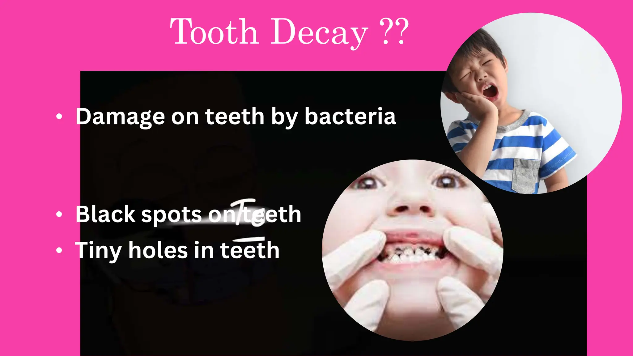 dental awareness workshop for Primary School | PPT
