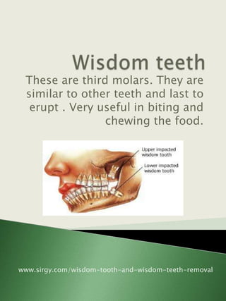 These are third molars. They are
 similar to other teeth and last to
  erupt . Very useful in biting and
                chewing the food.




www.sirgy.com/wisdom-tooth-and-wisdom-teeth-removal
 