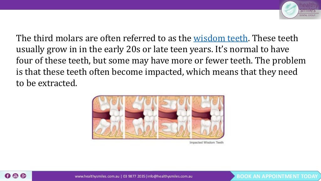 Wisdom Teeth Removal Understanding the Procedure