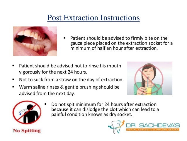 Wisdom Tooth Extraction | Dental Courses in India
