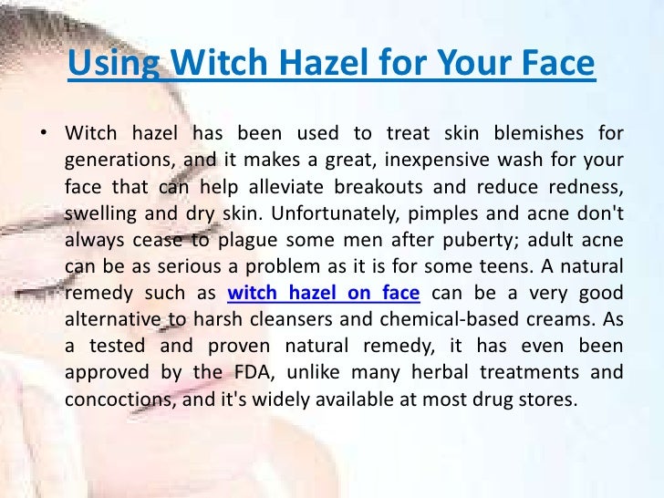 Using Witch Hazel For Natural Remedy Using Witch Hazel For Natural Remedy