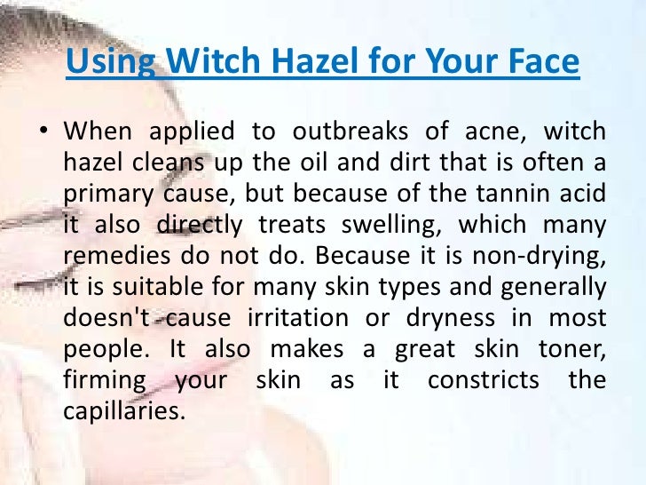 benefits of using witch hazel on face