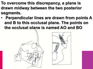 To overcome this discrepancy, a plane is
drawn midway between the two posterior
segments.
• Perpendicular lines are drawn from points A
and B to this occlusal plane. The points on
the occlusal plane is named AO and BO
respectively.
 